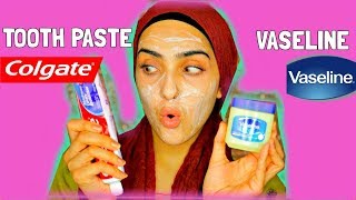 I APPLIED TOOTHPASTE AND VASELINE ON MY FACE  Look What Happened   Immy [upl. by Enomar]