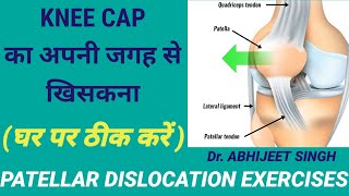 PATELLAR DISLOCATION EXERCISES IN HINDI  KNEE CAP DISLOCATION  KNEE CAP DISLOCATION EXERCISES [upl. by Hayilaa]