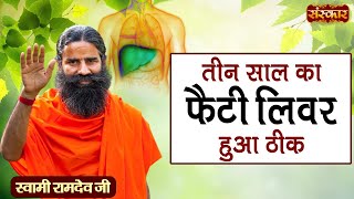 तीन साल का फैटी लिवर हुआ ठीक  Fatty Liver  Swami Ramdev Ji  Yog and Ayurveda  Sanskar TV [upl. by Reilly]