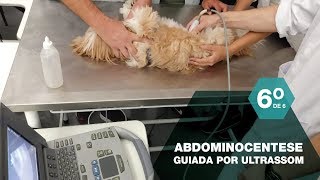 Abdominocentese guiada por ultrassom  procedimento minimamente invasivo [upl. by Ellenahs]