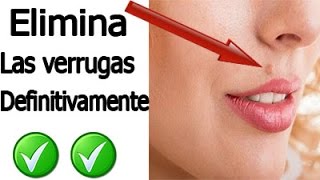 Tips antiverrugas Elimina Las Verrugas Solamente Usando Vaselina Con Vinagre De Sidra De Manzana [upl. by Coke812]