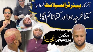 Hafiz Ahmed Hair Transplant Complete Procedure  Hafiz Ahmed [upl. by Leonsis]