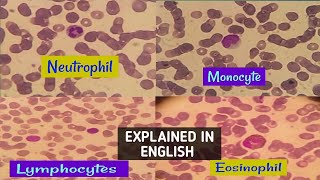 NeutrophilLymphocytemonocyte amp eosinophil actual view under microscopehow to differentiate easily [upl. by Cousin529]