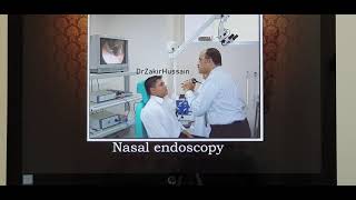 Nasal turbinate hypertrophy Part 1 English Patient teaching programme [upl. by Brier]