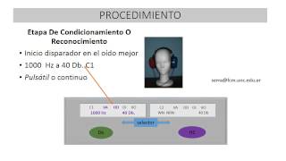 Tecnica procedimental audiométrica básica [upl. by Ebbarta]