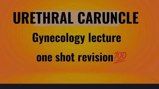 urethral caruncle gynecology lecture [upl. by Edlihtam]