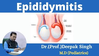 Epididymitis  Inflammation in epididymis  Deepak PD Singh [upl. by Weisbart]