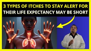 3 TYPES OF ITCHES TO STAY ALERT FOR  THEIR LIFE EXPECTANCY MAY BE SHORT [upl. by Huppert]