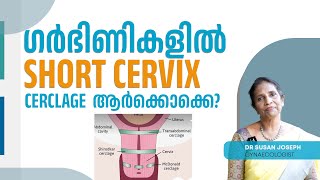 Short cervix പ്രശ്നമോ Cerclage എപ്പോൾ വേണം  DRSUSAN JOSEPH [upl. by Kilam221]