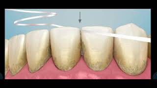 Interdental cleaning 🧹 with floss animation [upl. by Oinotnaocram]