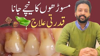 Easy Ways to GROW Receding Gums Back Naturally [upl. by Imuy]