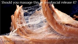 Myofascial release vs massage Chiropractor explains fascia [upl. by Nelle]