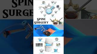 Spine Surgery with Duo™ Ti Expandable Interbody Fusion System from Spineology 3danimation short [upl. by Wavell]