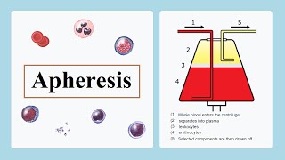 apheresis [upl. by Idissak202]