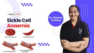 Sickle Cell Anaemia  Pathogenesis  Factors  Diagnosis by DR Priyanka Sachdev  MedLive [upl. by Falo]