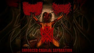 Infantectomy amp Coprocephalic Mutation  Enforced Cranial Separation 2019 Full Split [upl. by Aonehc]