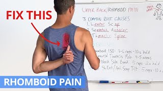 How to Fix Upper Back  Rhomboid Pain for GOOD 4 Effective Exercises [upl. by Lloyd]