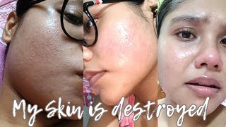 😭My Skin Is Destroyed😭  How I Cleared My Textured Skin ❤️‍🩹  Skincare Tips ✅ [upl. by Marybeth]