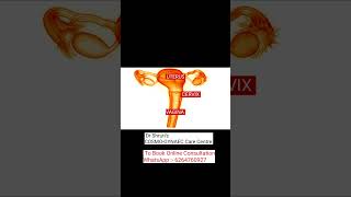 Understanding the uterus बच्चेदानी कैसी होती है  Dr Shrutis corner  Youtube shorts [upl. by Haldis]