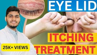 Eye Itching Causes Treatment Home remedies  Itching under Eye Skin [upl. by Quitt]