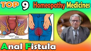 Anal Fistula Causes Symptoms and homeopathy Treatment  Dr P S Tiwari [upl. by Dez355]