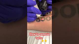 How to remove tattoo Easy tattoo removal by lazer treatment tattoo removal lazer tattooremoval [upl. by Atcliffe158]