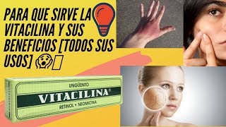 PARA QUÉ SIRVE LA VITACILINA 👍 BENEFICIOS DE LA VITACILINA 🔥 [upl. by Krutz]