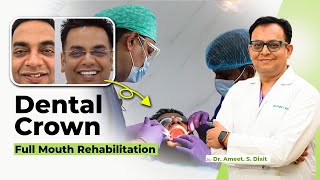 Amazing deep bite correction  Teeth restoration in Delhi [upl. by Altis]