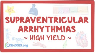 Supraventricular arrhythmias Pathology review [upl. by Analle]