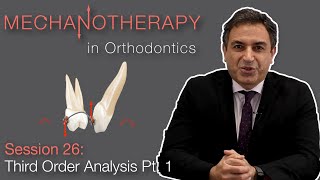 Mechanotherapy in Orthodontics Third Order Analysis Pt 1 [upl. by Agna936]