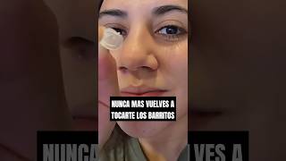 Ya no pellizques las espinillas😪 skincaretips acne espinillas skincarecommunity [upl. by Elvia]