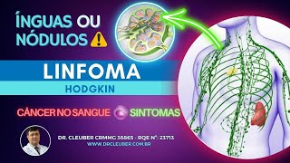 🟢 Linfoma de Hodgkin O que é ⚠️ Cuidado com Ínguas e Caroços [upl. by Buehrer]