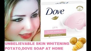 UNBELIEVABLE SKIN WHITENING POTATODOVE SOAP AT HOME [upl. by Aneeh]