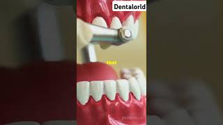 Unveiling in depth about periodontics or the department of tooth cleaningperiodonticstoothcleaning [upl. by Ellahcim254]