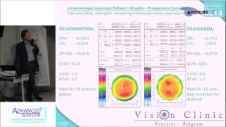 Dr Thierry VANDORSELAER  Les traitements Hypermétropiques donnent une bonne NV et DV [upl. by Dasya879]