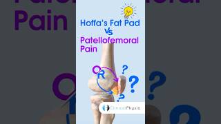 Hoffa’s Fat Pad vs Patellofemoral Pain physicaltherapy physiotheraphy kneepain [upl. by Hardner]