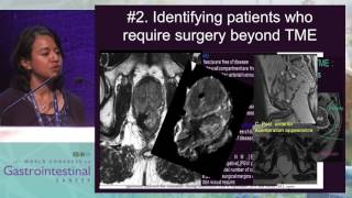 MRI in rectal cancer staging is mandatory [upl. by Puttergill]