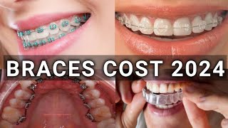 Braces Type amp Treatment Cost 2024  Metal vs Ceramic vs Lingual vs Invisalign Braces  Latest [upl. by Rue]