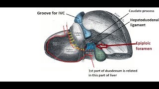 Epiploic foramen  easy and brief description [upl. by Oralie]