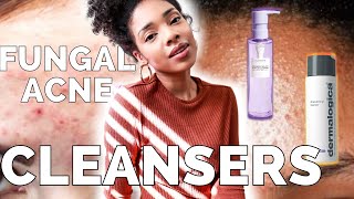 THE BEST CLEANSER  Fungal Acne Safe glow recipe dermalogica amp more [upl. by Yelsnik456]