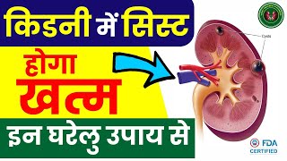 How To Cure Kidney Cyst Naturally  Polycystic Kidney Treatment  Kidney Treatment In Ayurveda [upl. by Hinkle]