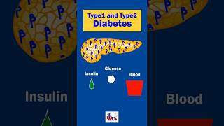 Type1 and Type 2 Diabetes  Know the difference DrTulip  JP Nagar [upl. by Tigdirb]