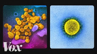 What the coronavirus looks like up close [upl. by Alamaj]