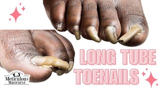 Trim Long Toenails Tutorial nails satisfying [upl. by Ivek108]