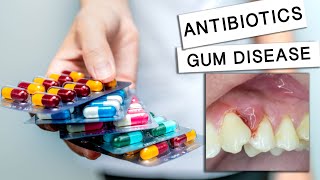 Can Antibiotics Cure Gum Disease [upl. by Leahplar]