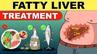 Fatty Liver Treatment  Fatty Liver Diet  Liver Detox  Fatty Liver  Fatty Liver Symptoms [upl. by Yeltsew635]