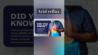 Acid reflux GERD symptoms and treatment [upl. by Pietro903]