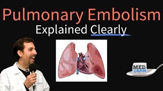 Pulmonary Embolism Explained Clearly  Risk factors Pathophysiology DVT Treatment [upl. by Ahseela191]