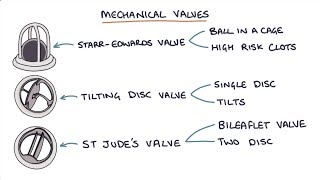 Prosthetic Heart Valves Visual Explanation for Students [upl. by Euqinot]