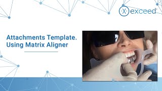 Attachments Template Using Matrix Aligner [upl. by Adnohsirk]